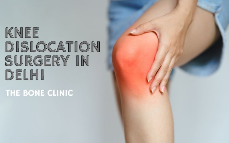 Knee Dislocation Surgery in Delhi