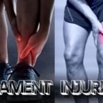 Ligament Injuries