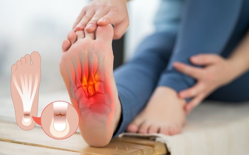 plantar fasciitis treatment in delhi