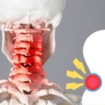 How do you relieve cervical neck pain? Orthopedic Doctor in Dwarka dELHI
