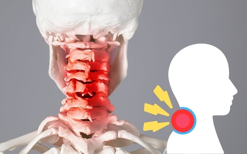 How do you relieve cervical neck pain? Orthopedic Doctor in Dwarka dELHI
