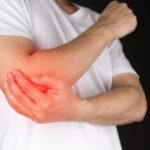 Bursitis symptoms and treatment in Delhi